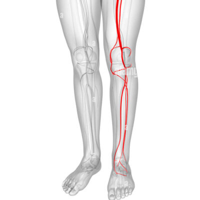 Ультразвукова діагностика судин кінцівок